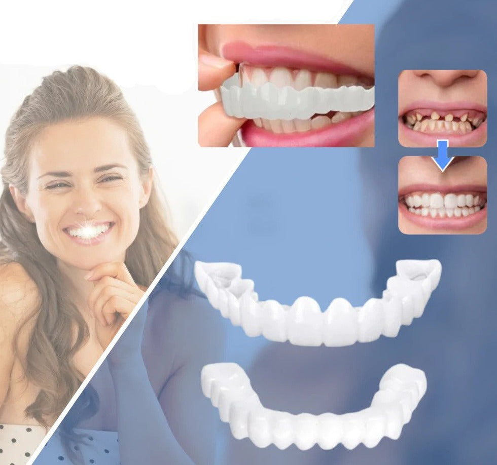 Skanto | Snap-on Teeth™ - With these veneers, always have the perfect smile
