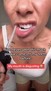 Skanto | USB Oral Care Water Flosser