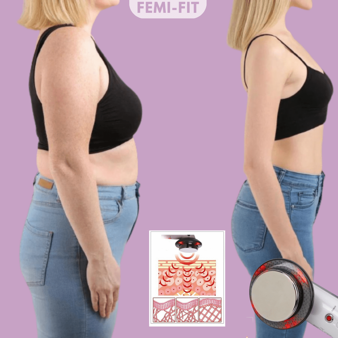 BowLift | 3-in-1 Cellulite and Fat Burner with EMS, Ultrasound & Infrared