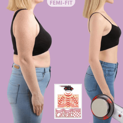 Skanto | 3-in-1 Cellulite & Fat Burner with EMS, Ultrasound & Infrared
