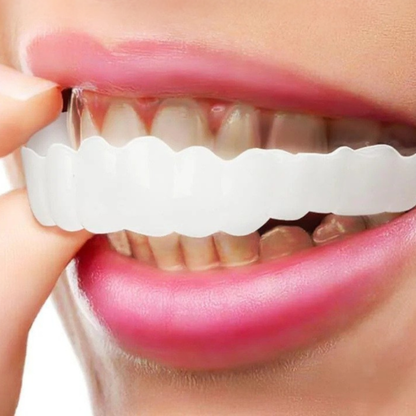 Removable Veneers - Dental Veneers