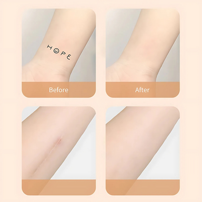 Scar covering patch, waterproof