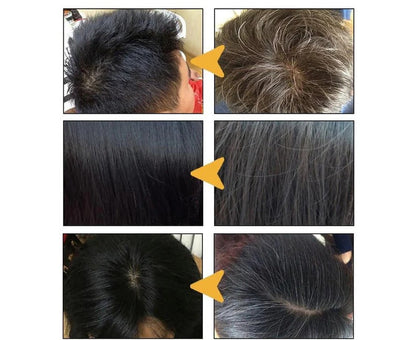 Skanto | Anti Gray Hair Shampoo Bar Treatment