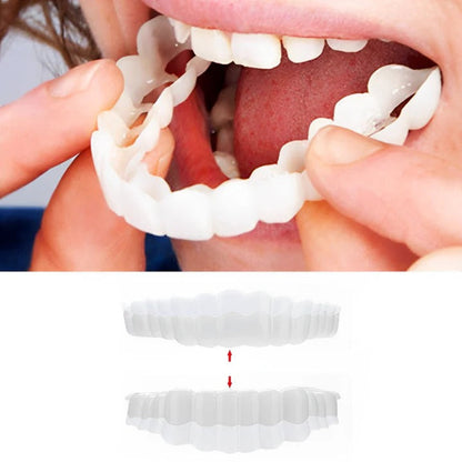 BowLift | Removable Smile Veneers for Upper and Lower Teeth
