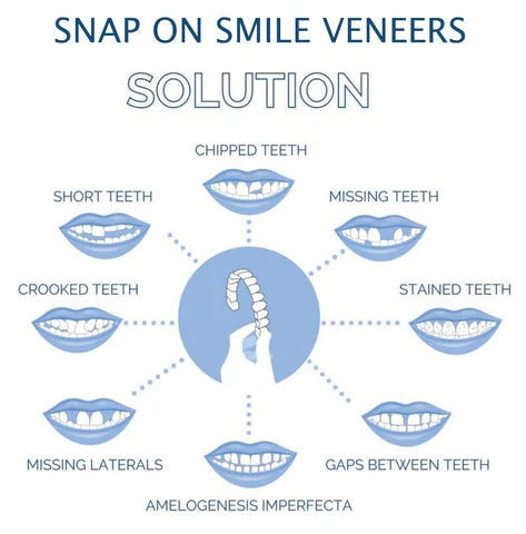 BowLift | Removable Smile Veneers for Upper and Lower Teeth