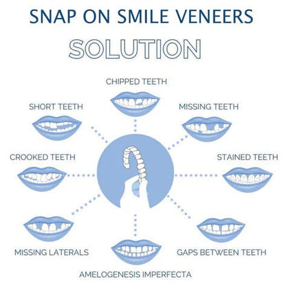 BowLift | Removable Smile Veneers for Upper and Lower Teeth