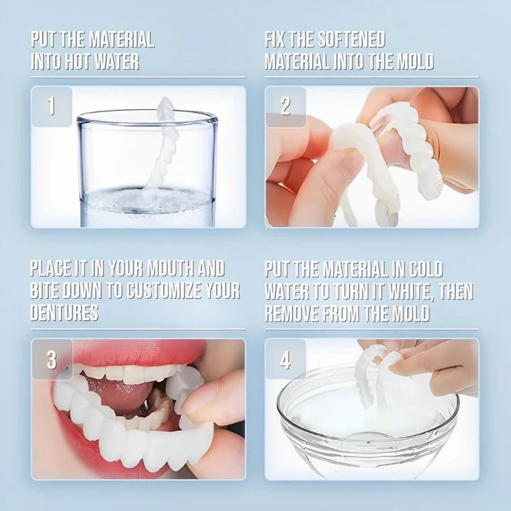 Skanto | Removable Smile Veneers for Upper and Lower Teeth
