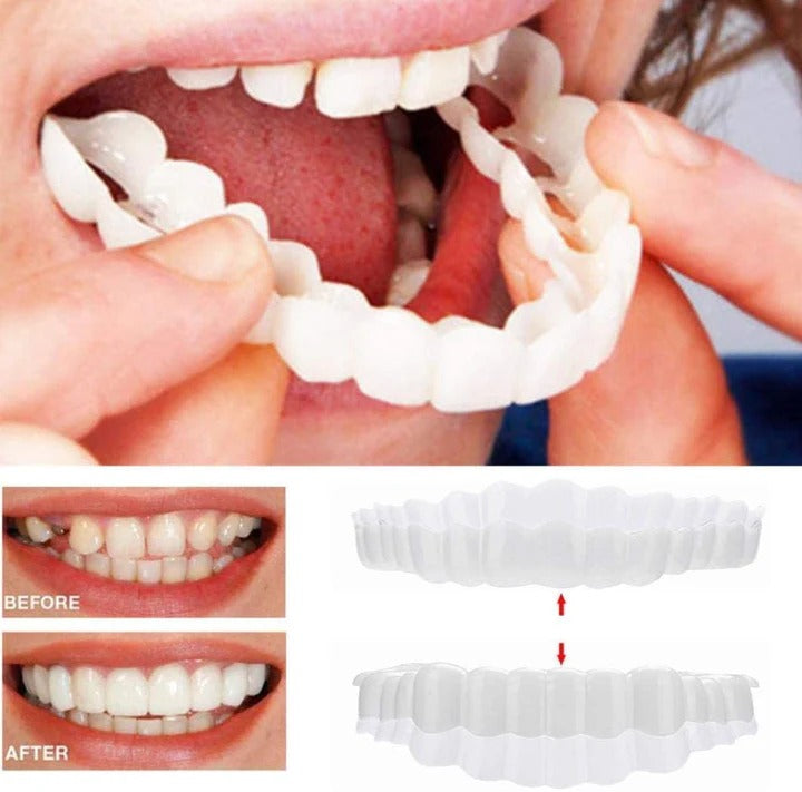 Skanto | Removable Smile Veneers for Upper and Lower Teeth