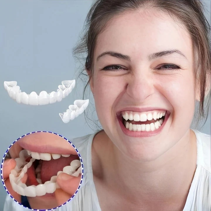 BowLift | Removable Smile Veneers for Upper and Lower Teeth