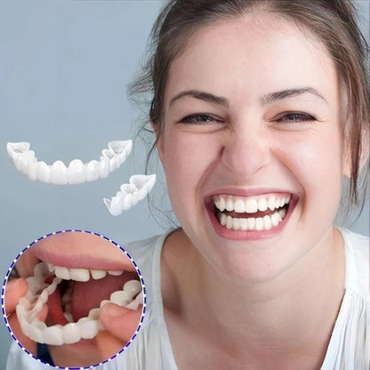 BowLift | Removable Smile Veneers for Upper and Lower Teeth