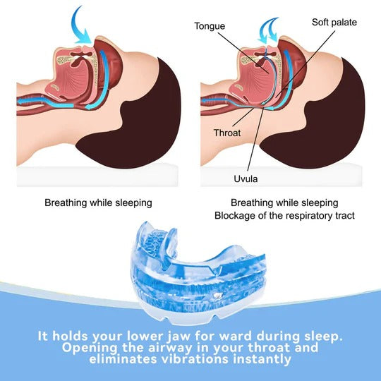 Skanto | Adjustable Anti-Snoring Mouthpiece