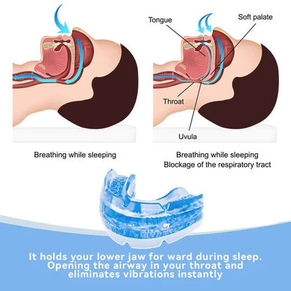 Skanto | Adjustable Anti-Snoring Mouthpiece