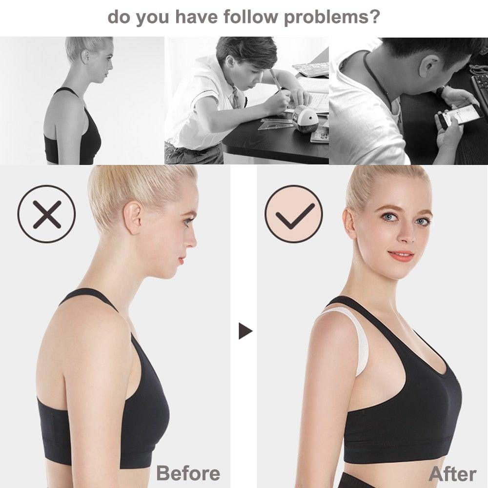 Skanto | Invisible Posture Corrector