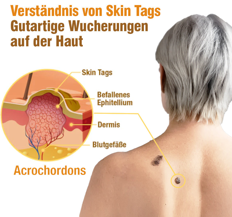 TagRecede Bee Gift Spray | Natural Skin Perfection | Bowlift
