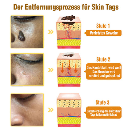 TagRecede Bee Gift Spray | Natural Skin Perfection | Bowlift