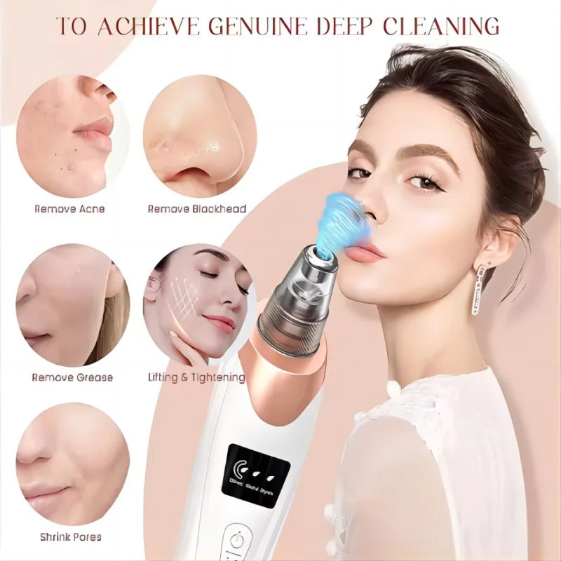 Skanto | Blackhead Remover Vacuum Pore Cleaner | Adjustable Suction, Multifunctional Tool for Deep Cleansing and Acne Treatment at Home