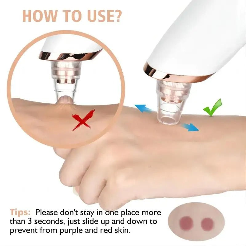 Skanto | Blackhead Remover Vacuum Pore Cleaner | Adjustable Suction, Multifunctional Tool for Deep Cleansing and Acne Treatment at Home