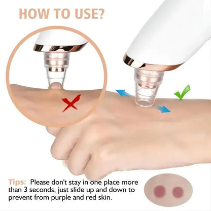 Skanto | Blackhead Remover Vacuum Pore Cleaner | Adjustable Suction, Multifunctional Tool for Deep Cleansing and Acne Treatment at Home