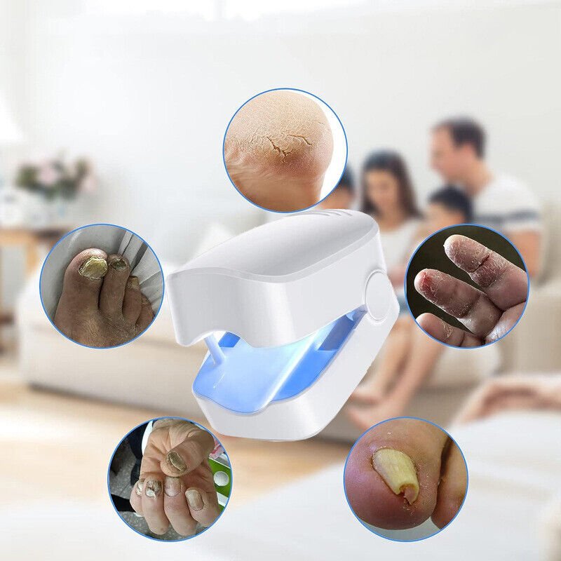 Skanto | Laser Nail Fungus Cleaner – Revolutionary, High-Efficiency Light Therapy Device from Expert for Toenail Conditions