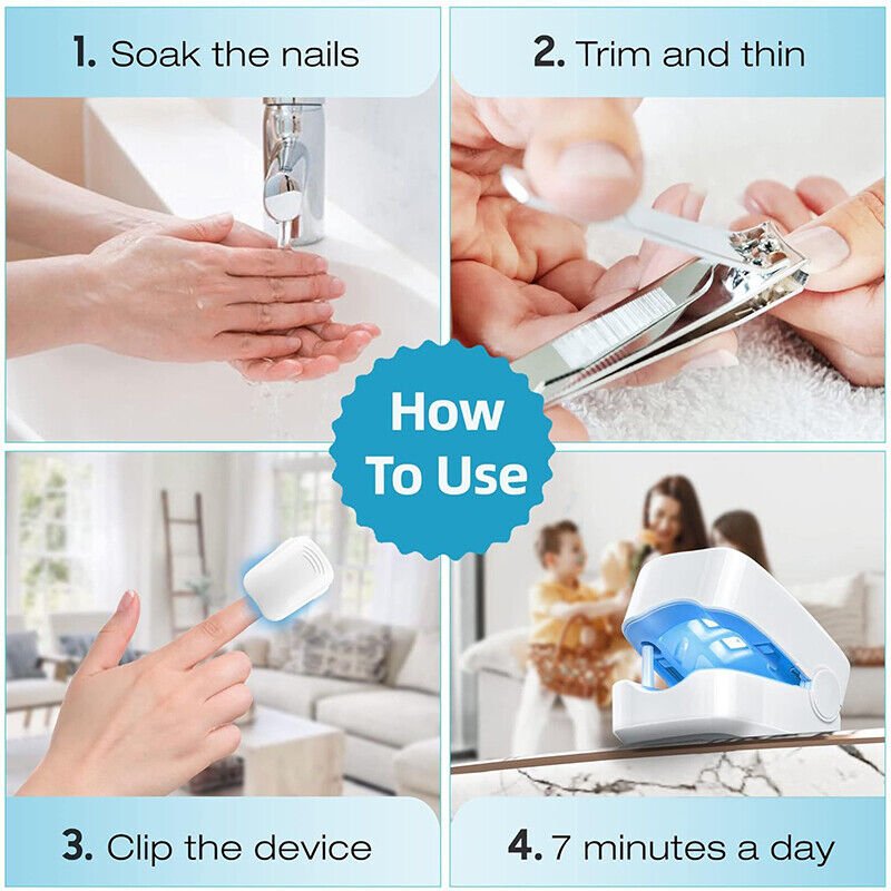 Skanto | Laser Nail Fungus Cleaner – Revolutionary, High-Efficiency Light Therapy Device from Expert for Toenail Conditions
