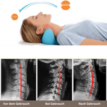 Skanto | Nekra – Ergonomic Neck Massage Pillow for Comfort and Relaxation