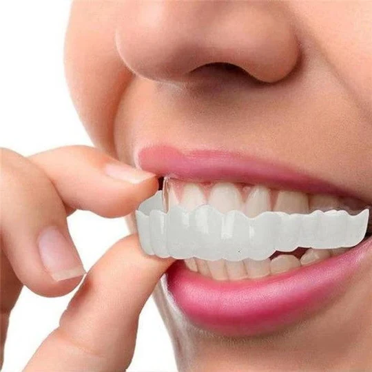 BowLift | Smile Veneer (Upper & Lower Included)