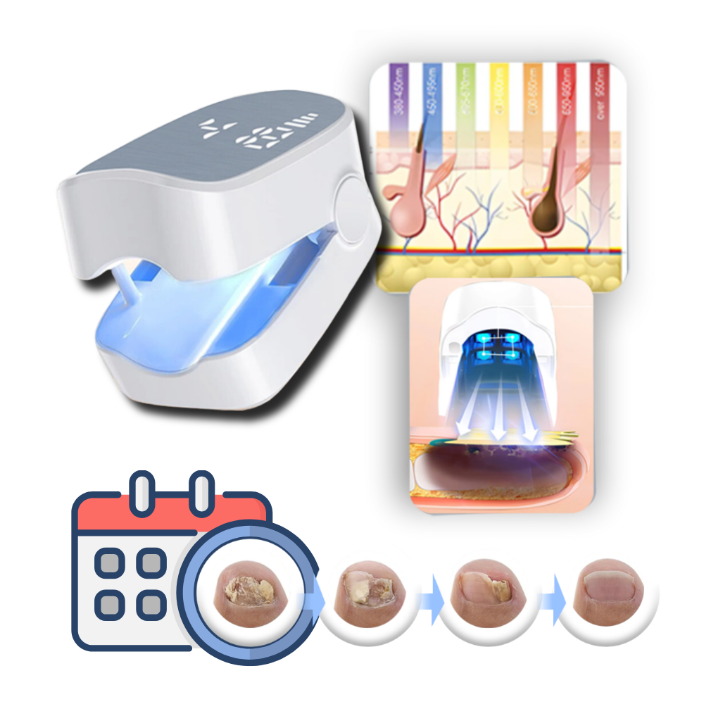 Painless Nail Fungus Laser
