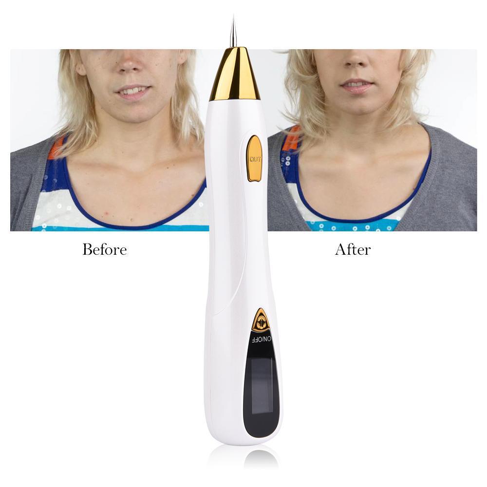 Brehn | Deluxe Skin Tag, Mole, Freckle, Skin Blemish, and Wart Remover