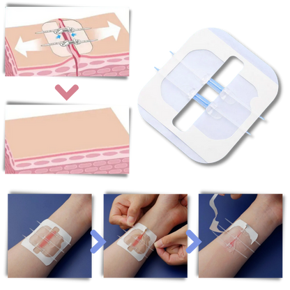 Waterproof Adhesive for Wounds