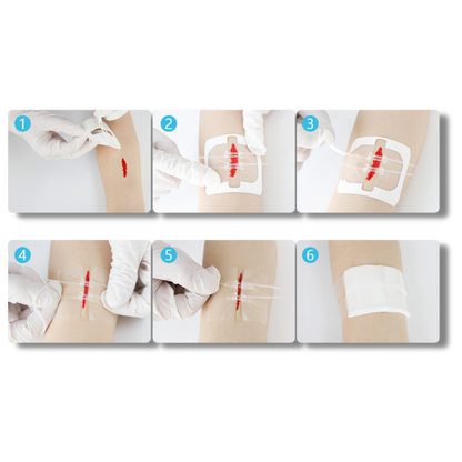 Waterproof Adhesive for Wounds