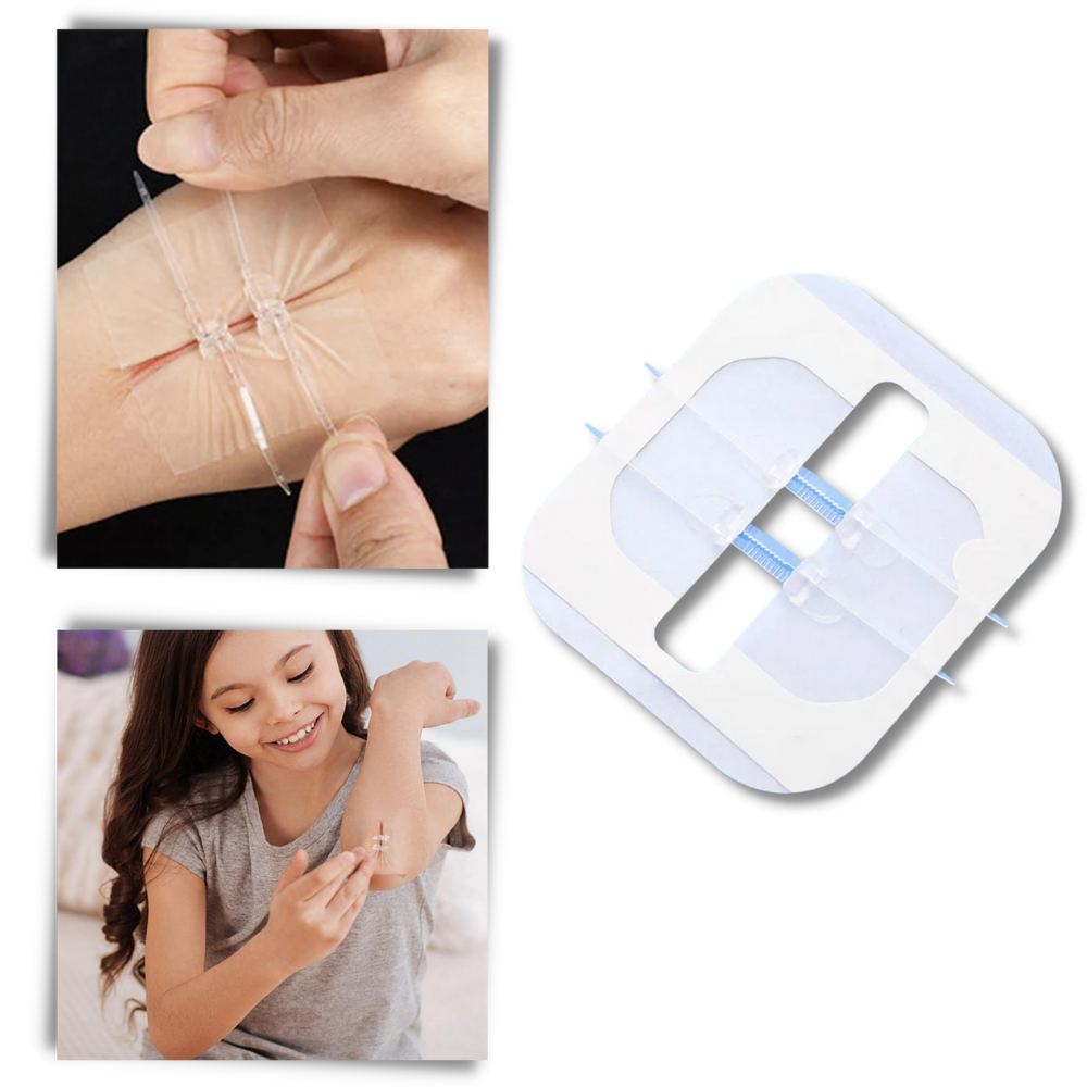 Waterproof Adhesive for Wounds
