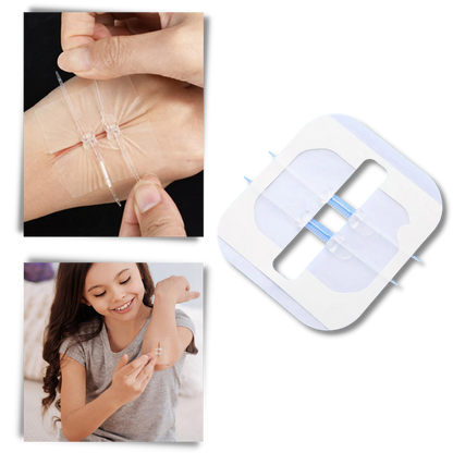 Waterproof Adhesive for Wounds