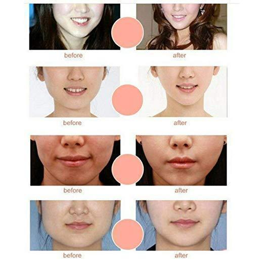 Skanto | V-Line Chin Up Face Lift Mask