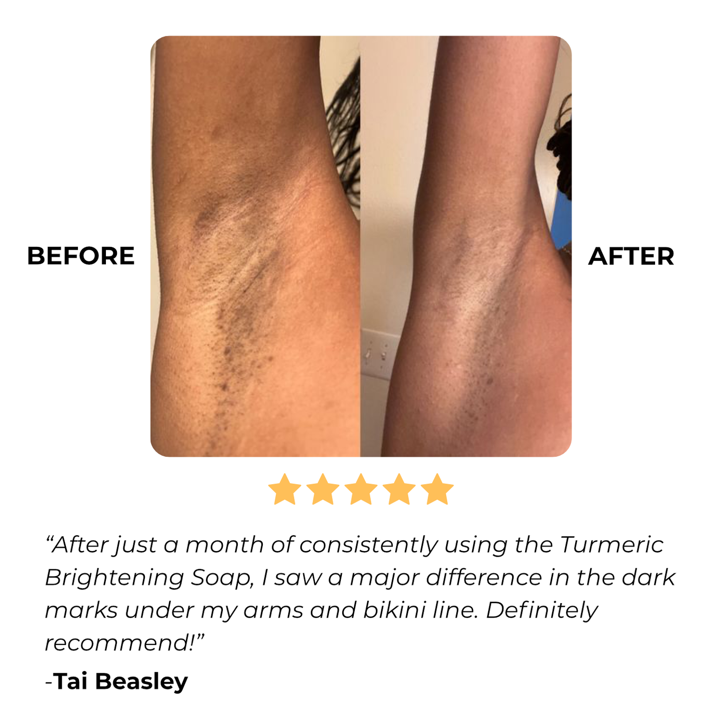 Skanto | Vitalume - Turmeric Brightening Soap (1+1 Free)