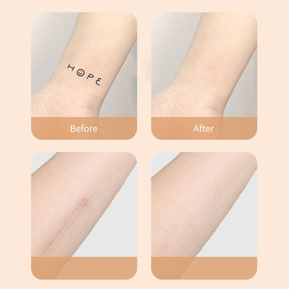 New Products Ultra-Thin Tattoo and Scar Concealer Patch