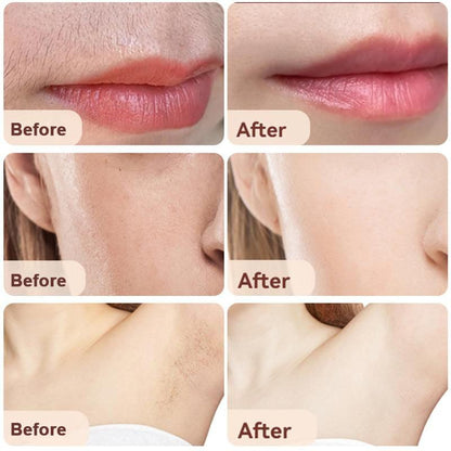 Skanto | 2-in-1 Facial Hair Remover & Eyebrow Trimmer (50% Off)