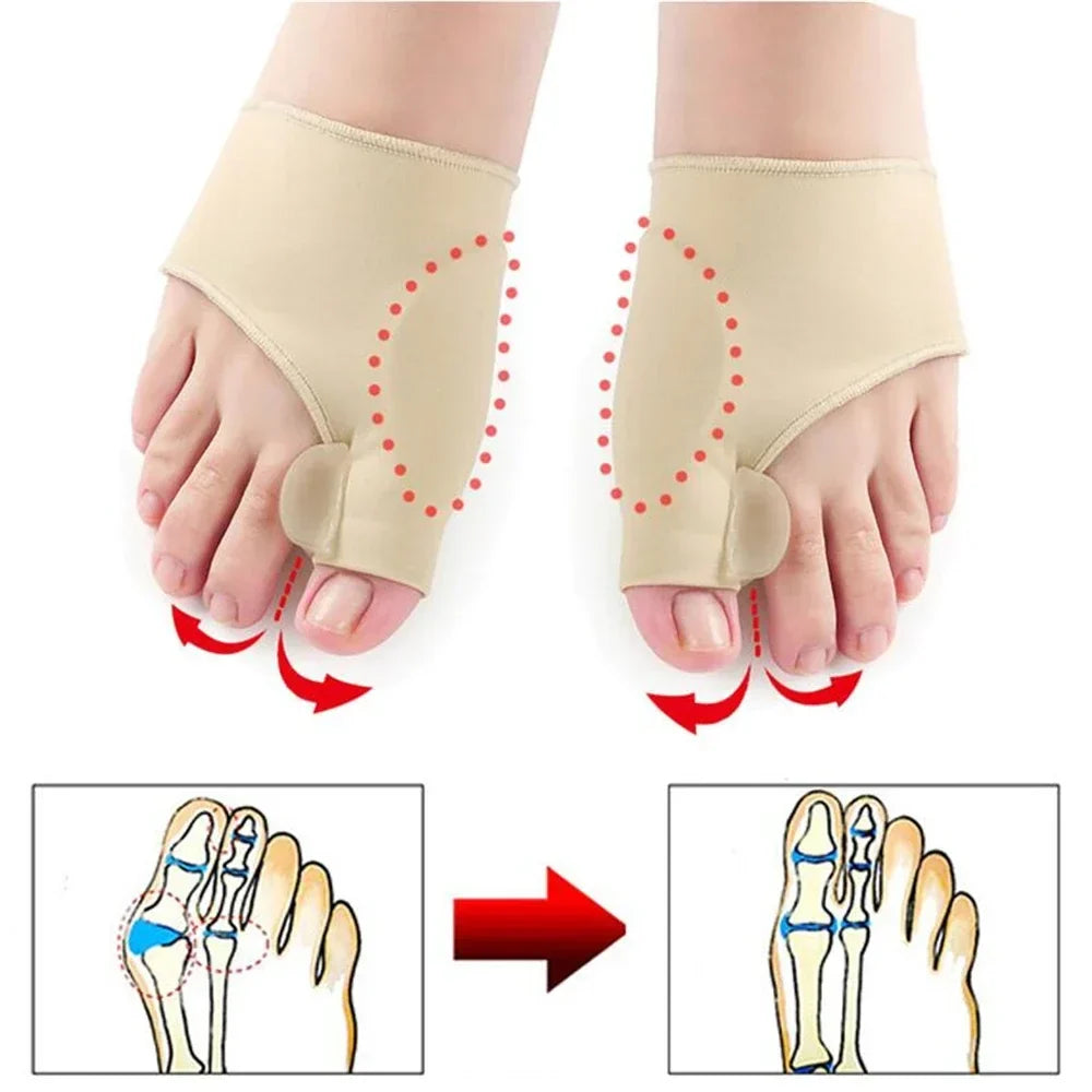 BowLift | Toe Valgus Corrective Socks